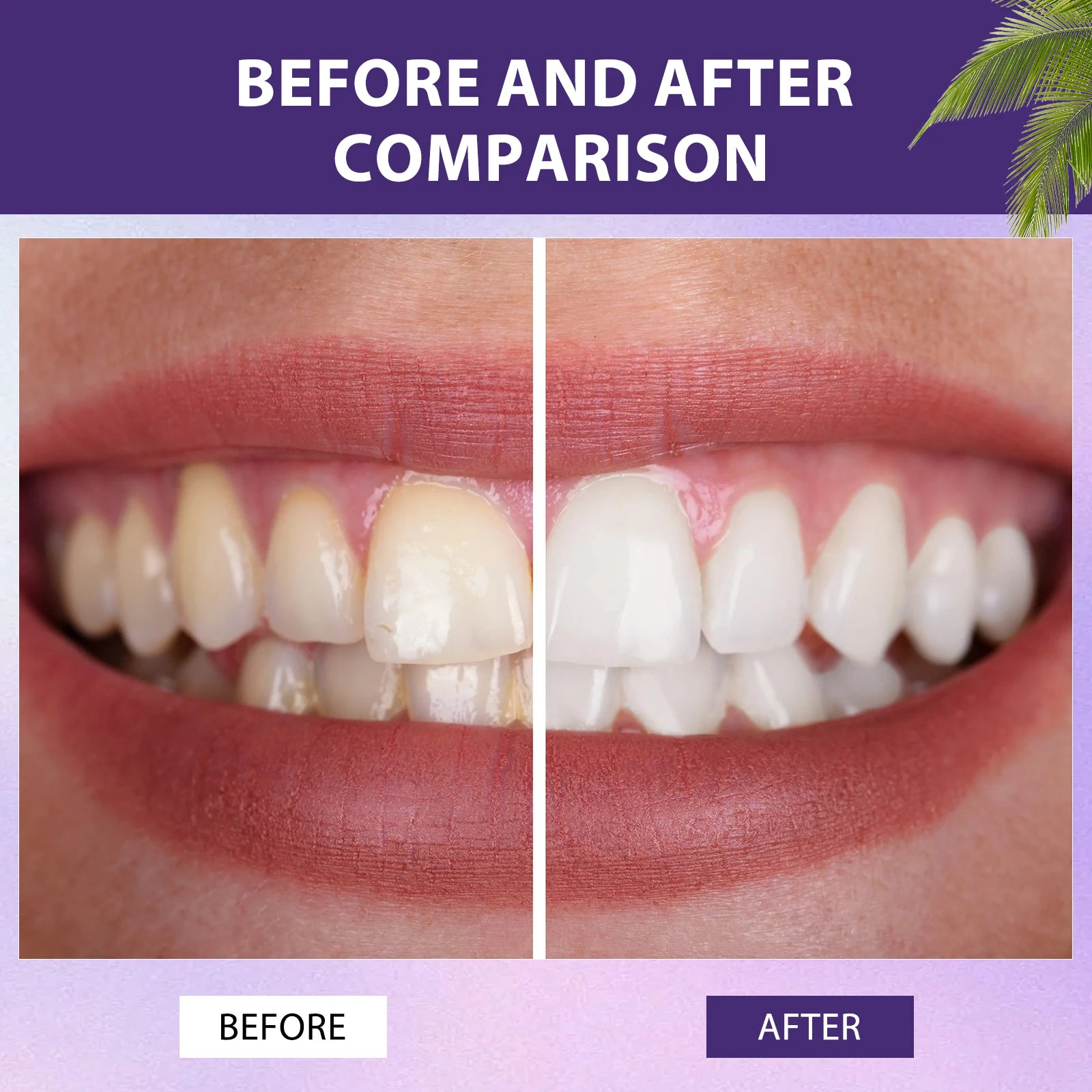 Mineral whitening tooth powder application